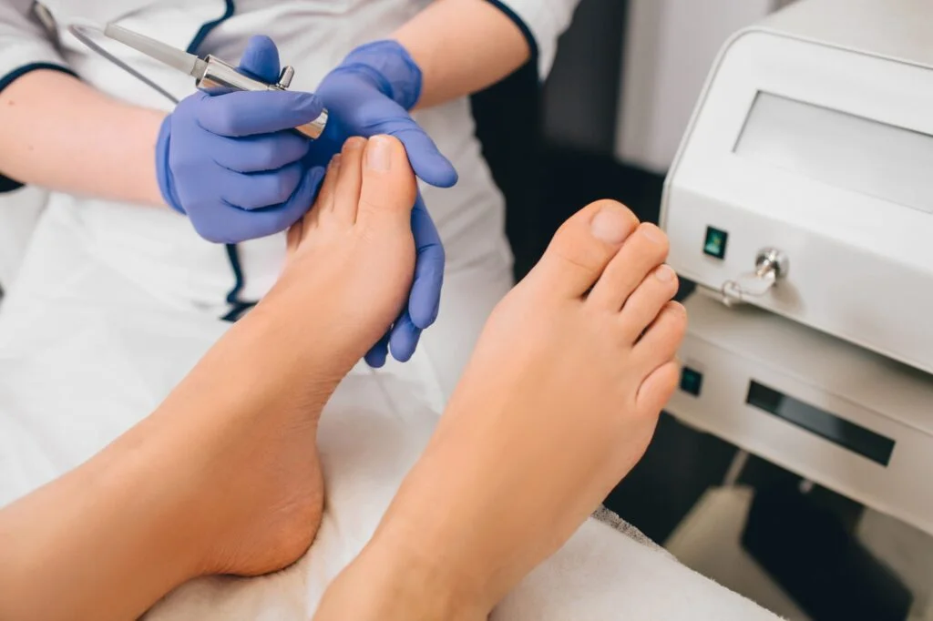 Person holding a magnifying glass over a toenail with a fungal infection.